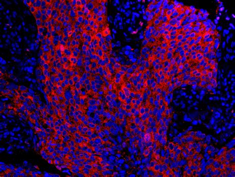 sigma antibodies